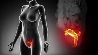 Egg donation treatment. Preparation of the endometrial cavity for embryo reception