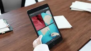 4REMOTE Health - Digital Surgery (ENG)