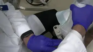 DermaPACE provides quick treatment for diabetes wounds