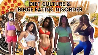 How I Let Diet Culture and Binge Eating Disorder Ruin My Life for Years | BED Recovery Journey