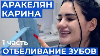 Карина Аракелян отбеливание зубов. 1 серия