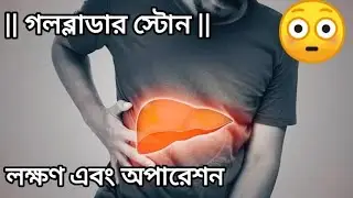 || গলব্লাডার স্টোন || লক্ষণ এবং অপারেশন