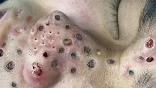 تلميع وتنظيف الجلد الطبيعي المدور 1413596