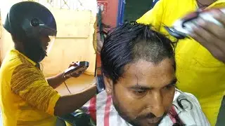 trimmer se hair remove kaise kare || ट्रिमर से हेयर रिमूव कैसे करें || full step by step tutorial