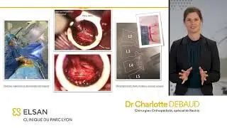 Techniques mini-invasives en chirurgie du rachis - Dr Charlotte DEBAUD, chirurgien orthopédiste