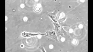 MHC-class-II are expressed in a subpopulation of human neural stem cells in vitro in an IFNγ