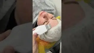 В наличии новый аппарат для очистки лица.