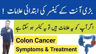 Colon Cancer Symptoms & Treatment In Urdu Hindi - Irfan Azeem