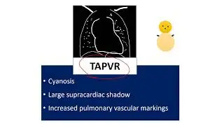 Cardiology Last-Minute Review