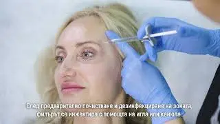 Филъри в зоната на слепоочието