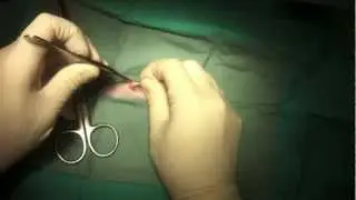Cat Spay: In heat