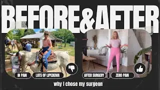 NO MORE PAIN (why I chose my Lipedema surgeon)