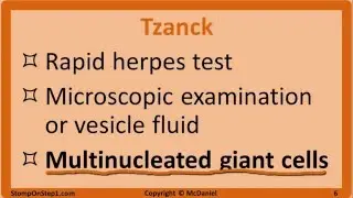 Herpes: Mono, HSV, Chickenpox, Shingles, EBV, CMV, Cold Sore, VZV Varicella