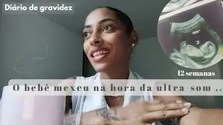 Diário de gravidez|12 semanas- meu bebê mexeu na ultra - sintomas e sentimentos na gestação