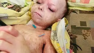 ГОСПИТАЛИЗАЦИЯ в Краснодар | ХИМИОТЕРАПИЯ | Марк и друзья | Жизнь и лечение после ТКМ