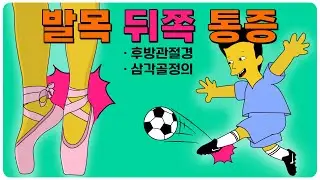 발목 뒤쪽 통증(삼각골)1 - 후방관절경, 삼각골정의