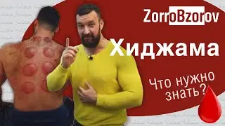 Ликбез про ХИДЖАМУ. Центр Авиценна
