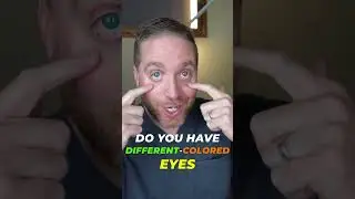 Do You Have Heterochromia? 