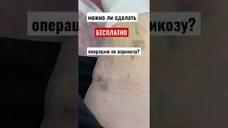 😱ВАРИКОЗ-БЕСПЛАТНАЯ ОПЕРАЦИЯ? 