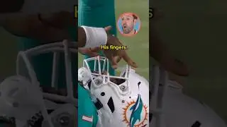 ER Doctor REACTS to NFL Football Injuries