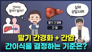 말기 간경화, 간암) 간이식, 언제 해야 할까? 명쾌한 최원장의 간이식 판단 기준은?