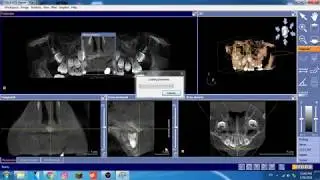 Galileos Viewer  - Dental Software