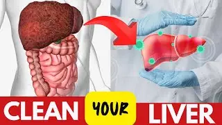 Fatty Liver. How to FIX Fatter Liver. Signs & Symptoms and Treatment of Fatter Liver.