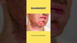What is the correct diagnosis? #shorts