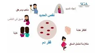 فقر الدم عند مرضى الكرون والتهاب القولون التقرحي