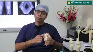 Listen to Dr. Aman Dua on Knee Arthritis' and about 'Need for Knee Replacement'
