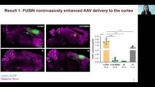 Dezhuang Ye: FUS-Mediated Intranasal Delivery of AAV to Targeted Brain Regions