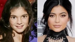 Kylie Jenner's Beauty Transformation 2007 - 2015