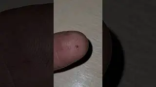 ОПАСНЫЙ МИНИ КЛЕЩ. ЭВОЛЮЦИЯ.
