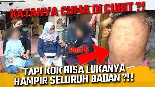 ALASANYA CUMA DI CUBIT !! TAPI LUKANYA KOK HAMPIR SELURUH BADAN ??