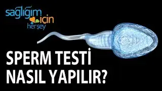 How is a Sperm Test Done?