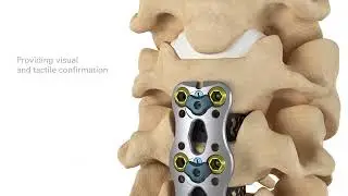 ACP - Product animation
