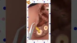 ear cleaning asmr animation horror part3👻👂🏻deep ear cleaning asmr#animation#asmr#ytshortsvideo#short