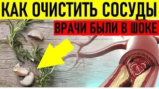 ЧИСТИМ СОСУДЫ | Держи сосуды в чистоте!
