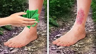 Most Poisonous and Painful Plants Waiting For Your Wrong Step