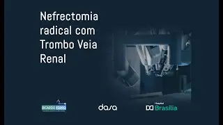 Nefrectomia radical com Trombo Veia Renal