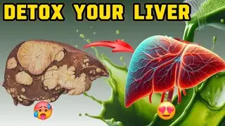 BEST FOODS TO DETOX AND CLEAN OUT YOUR LIVER #liverdetox #detoxfoods