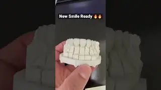 New Smile Ready 🔥 