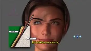 LIFTING FRONTAL - Dra. Débora Tomatis Pacheco - Cirurgia Plástica - Porto Alegre/RS