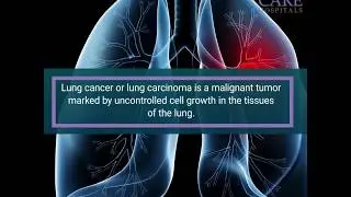 Lung Cancer - Symptoms and Treatment | CARE Hospitals, India