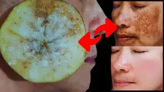 1 slice of apple attracts impurities on the face like a magnet! Effective stain remover