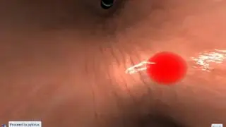 EndoSim Upper GI: Proceed to pylorus