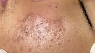 Satisfying Relaxing with Sac Dep Spa 