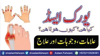 Uric Acid Causes, Symptoms and Treatment In Urdu/Hindi - Uric Acid ka Elaj  by Dr.Aslam Faheem