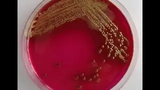 Maintenance and Storage of DH5 alpha E.coli Cells - Amrita University