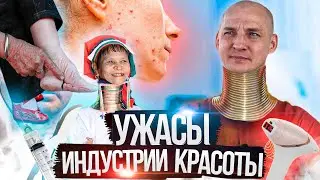 ЭЛЕКТРОЭПИЛЯЦИЯ, БИНТОВАНИЕ НОГ, КОЛЬЦА НА ШЕЕ | НА ЧТО ГОТОВЫ ЖЕНЩИНЫ, ЧТОБЫ БЫТЬ КРАСИВЫМИ?